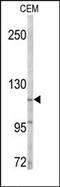 ACK1 antibody, AP14454PU-N, Origene, Western Blot image 