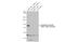 Androgen Receptor antibody, GTX635842, GeneTex, Western Blot image 