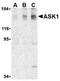 Mitogen-Activated Protein Kinase Kinase Kinase 5 antibody, TA306284, Origene, Western Blot image 