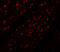 Ribosomal Oxygenase 2 antibody, A32122, Boster Biological Technology, Immunofluorescence image 