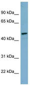 Iroquois-class homeodomain protein IRX-1 antibody, TA342478, Origene, Western Blot image 