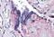 CD276 Molecule antibody, MBS245290, MyBioSource, Immunohistochemistry paraffin image 