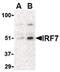 Interferon Regulatory Factor 7 antibody, PA5-20281, Invitrogen Antibodies, Western Blot image 