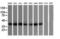 Mitogen-Activated Protein Kinase Kinase 3 antibody, M02916-2, Boster Biological Technology, Western Blot image 