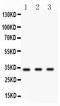 Cyclin D1 antibody, LS-C357565, Lifespan Biosciences, Western Blot image 