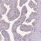 Lebercilin LCA5 antibody, NBP2-48587, Novus Biologicals, Immunohistochemistry paraffin image 