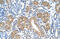 FAH antibody, ARP41681_T100, Aviva Systems Biology, Immunohistochemistry paraffin image 