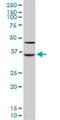 Sorbitol Dehydrogenase antibody, H00006652-M01, Novus Biologicals, Western Blot image 