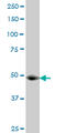 Lysine Acetyltransferase 2A antibody, LS-C133217, Lifespan Biosciences, Western Blot image 