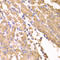 SUFU Negative Regulator Of Hedgehog Signaling antibody, LS-C334926, Lifespan Biosciences, Immunohistochemistry paraffin image 