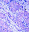 3-phosphoinositide-dependent protein kinase 1 antibody, LS-C336059, Lifespan Biosciences, Immunohistochemistry paraffin image 