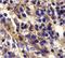 C-X-C Motif Chemokine Receptor 6 antibody, PA5-19936, Invitrogen Antibodies, Immunohistochemistry paraffin image 