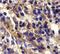 C-X-C Motif Chemokine Receptor 6 antibody, PA5-19936, Invitrogen Antibodies, Immunohistochemistry paraffin image 