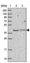 Transmembrane Protein 121 antibody, PA5-62065, Invitrogen Antibodies, Western Blot image 