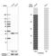 Family With Sequence Similarity 92 Member A antibody, NBP1-93794, Novus Biologicals, Western Blot image 