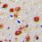 WW Domain Containing Oxidoreductase antibody, orb393188, Biorbyt, Immunohistochemistry paraffin image 