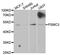 Proteasome 26S Subunit, ATPase 3 antibody, A13345, ABclonal Technology, Western Blot image 