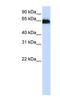 ADAM Metallopeptidase Domain 12 antibody, NBP1-59142, Novus Biologicals, Western Blot image 