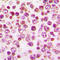 Colony Stimulating Factor 1 Receptor antibody, LS-C358957, Lifespan Biosciences, Immunohistochemistry paraffin image 