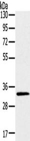Edpk antibody, TA350459, Origene, Western Blot image 