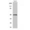 Matrix Metallopeptidase 13 antibody, LS-C384606, Lifespan Biosciences, Western Blot image 