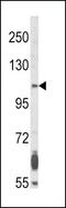 Fibroblast Growth Factor Receptor 2 antibody, GTX81341, GeneTex, Western Blot image 