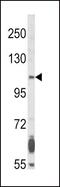 KGFR antibody, GTX81341, GeneTex, Western Blot image 