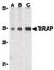 TIR Domain Containing Adaptor Protein antibody, orb87367, Biorbyt, Western Blot image 