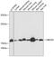 Ubiquitin Conjugating Enzyme E2 L6 antibody, GTX66195, GeneTex, Western Blot image 
