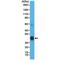 Pulmonary surfactant-associated protein A2 antibody, M04967, Boster Biological Technology, Western Blot image 