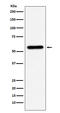 Carboxylesterase 1 antibody, M01741, Boster Biological Technology, Western Blot image 