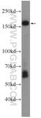 ATP Binding Cassette Subfamily A Member 8 antibody, 24351-1-AP, Proteintech Group, Western Blot image 