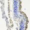 Microtubule Affinity Regulating Kinase 1 antibody, STJ110733, St John
