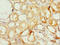 Proteasome Inhibitor Subunit 1 antibody, LS-C676330, Lifespan Biosciences, Immunohistochemistry paraffin image 