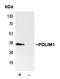 PDZ And LIM Domain 1 antibody, LS-C353135, Lifespan Biosciences, Immunoprecipitation image 