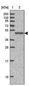 A-Kinase Anchoring Protein 5 antibody, PA5-62863, Invitrogen Antibodies, Western Blot image 