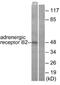 Adrenoceptor Beta 2 antibody, ab61778, Abcam, Western Blot image 