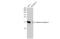 Anterior Gradient 2, Protein Disulphide Isomerase Family Member antibody, GTX130229, GeneTex, Western Blot image 