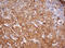 Proteasome Subunit Alpha 2 antibody, LS-C174178, Lifespan Biosciences, Immunohistochemistry paraffin image 