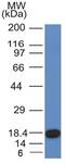 c-Kit antibody, GTX34607, GeneTex, Western Blot image 