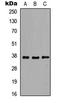 Microtubule Associated Protein RP/EB Family Member 2 antibody, LS-C354353, Lifespan Biosciences, Western Blot image 