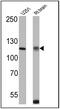 Calcium Sensing Receptor antibody, PA1-934A, Invitrogen Antibodies, Western Blot image 