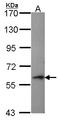 Perforin 1 antibody, LS-C185482, Lifespan Biosciences, Western Blot image 