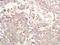 TNFAIP3 Interacting Protein 1 antibody, orb158629, Biorbyt, Immunohistochemistry paraffin image 