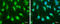 Suppressor Of Cytokine Signaling 1 antibody, GTX100657, GeneTex, Immunocytochemistry image 