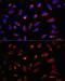 Glycine Cleavage System Protein H antibody, GTX66196, GeneTex, Immunocytochemistry image 