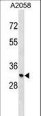 Monoglyceride Lipase antibody, LS-C164178, Lifespan Biosciences, Western Blot image 