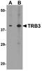 Tribbles Pseudokinase 3 antibody, A01414, Boster Biological Technology, Western Blot image 