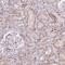 ETS Transcription Factor ERG antibody, NBP2-38555, Novus Biologicals, Immunohistochemistry paraffin image 