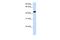 Arylacetamide Deacetylase antibody, PA5-42693, Invitrogen Antibodies, Western Blot image 